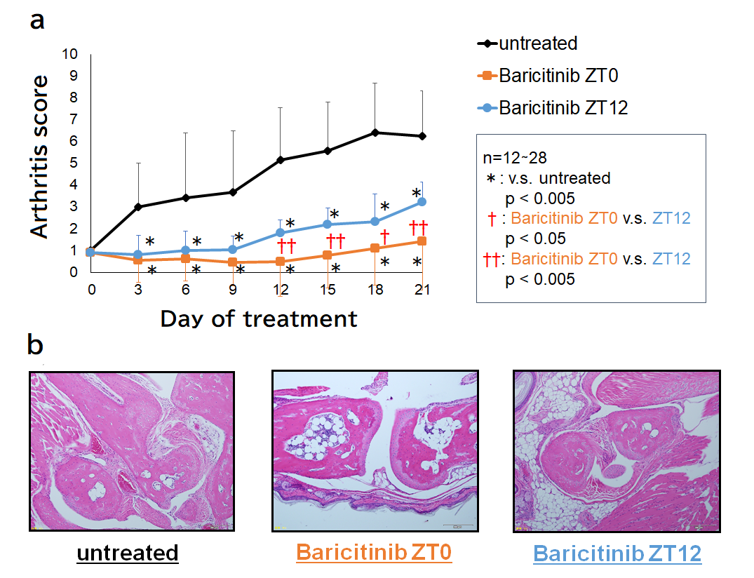 Baricitinib