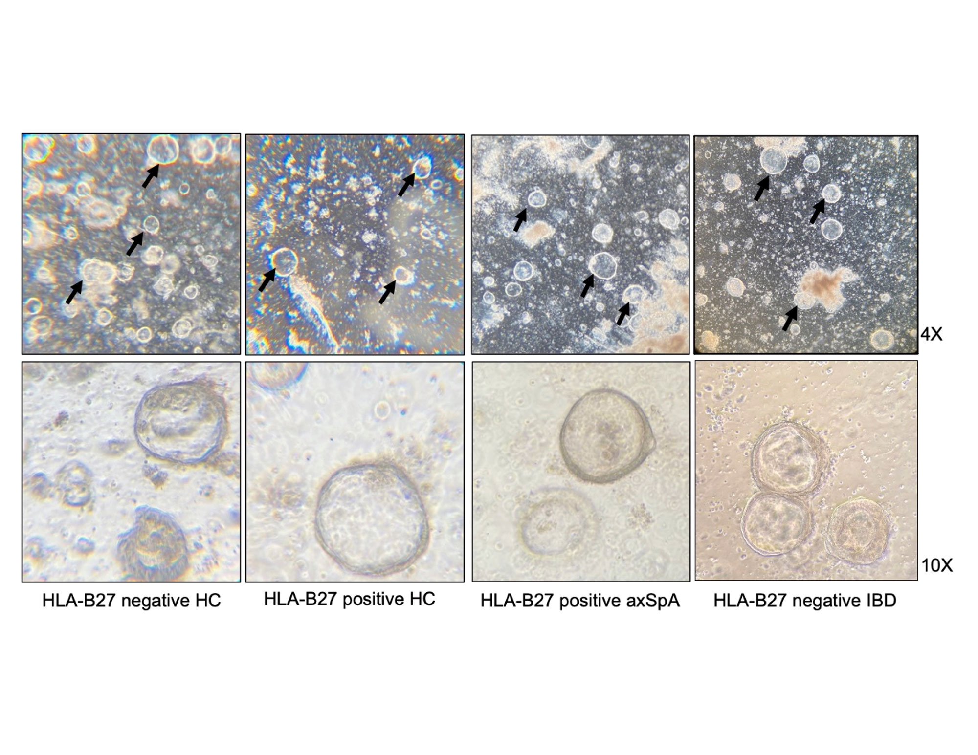 Colonic Organoids to Study the Role of HLAB27 in Gastrointestinal